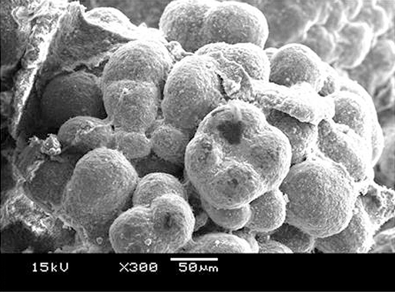 Example of Bacteria in Concrete